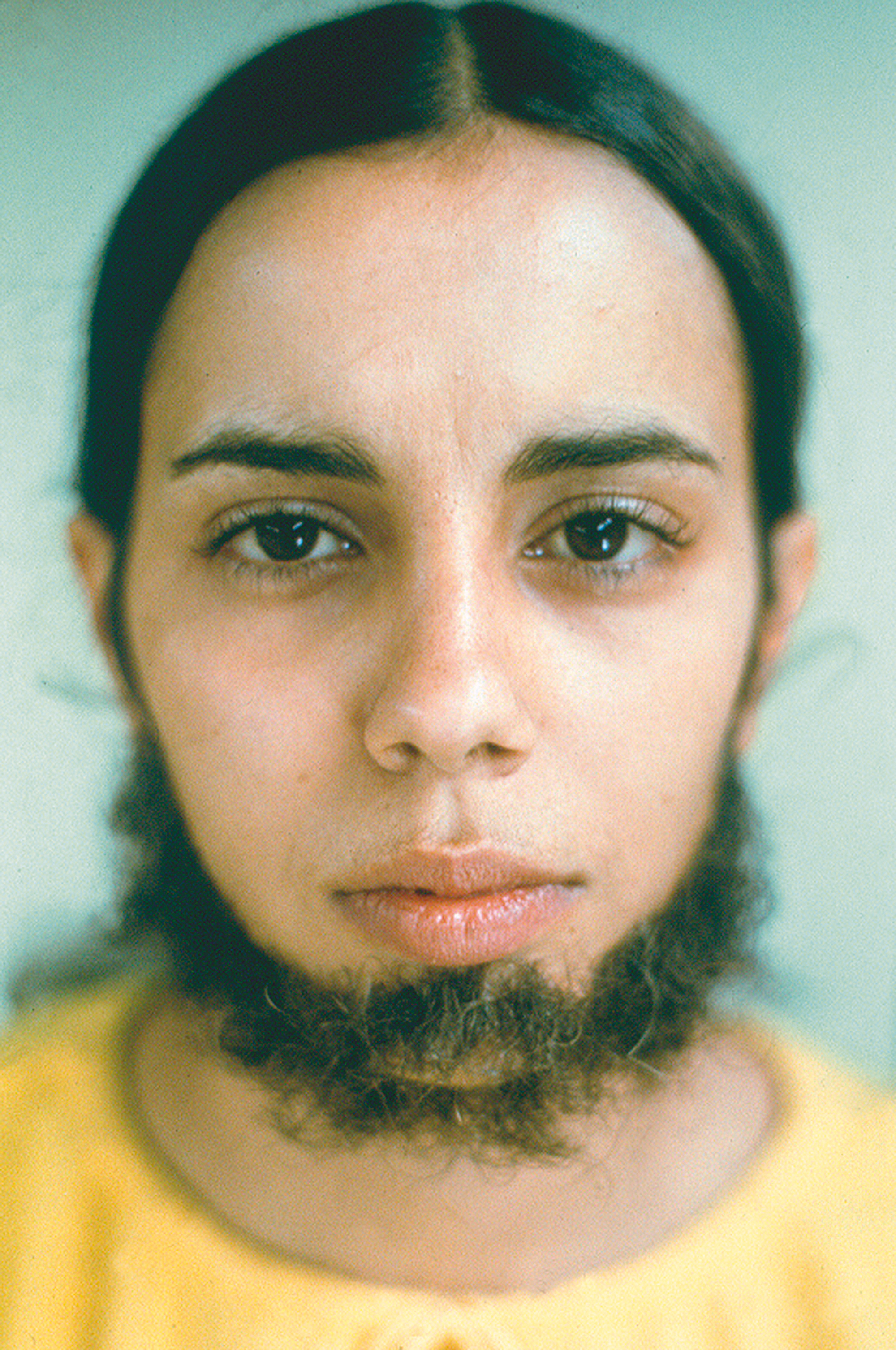 Ana Mendieta, ”Untitled (Facial Hair Transplants)”, 1972. Foto: © The Estate of Ana Mendieta Collection, LLC Courtesy Galerie Lelong & Co.