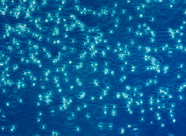 pblot (2)